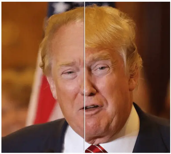 Has Donald Trump had plastic surgery? Just curious.